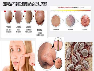 ������ĵ�&ldquo;Ƥ�w���m��&rdquo;&mdash;&mdash;��΢С����