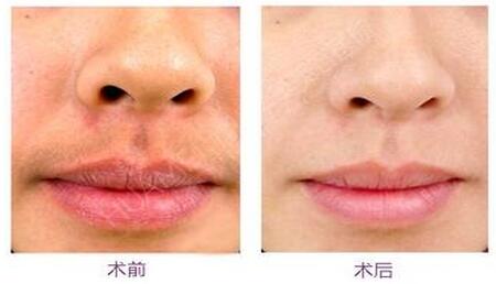 Óë�����Ҍ��Ãx��