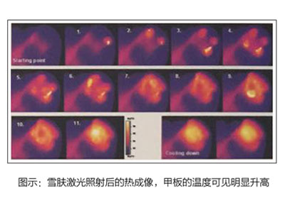 ѩ�w�װ_��������x