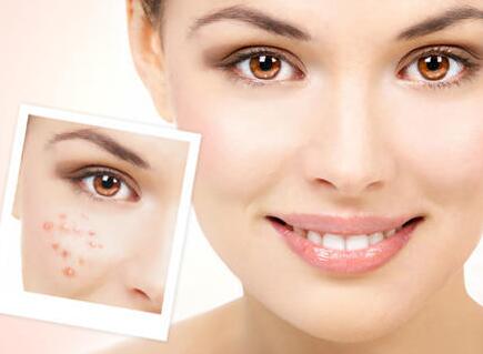 opt�x���S��