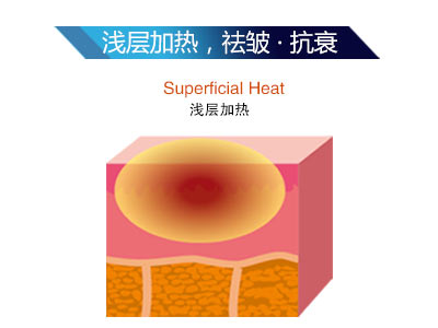熱拉提LTV-FD+到底為什么這么火