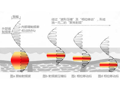 熱拉提LTV-FD+到底為什么這么火