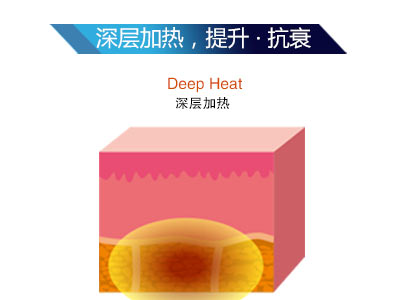 熱拉提LTV-FD+到底為什么這么火