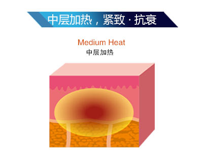 熱拉提LTV-FD+到底為什么這么火