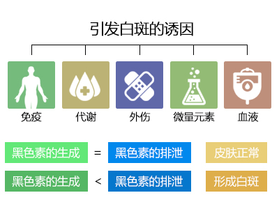 白癜風誘因