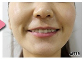 ˮ��ע��x�������ȈD2